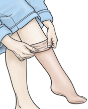 Mujer que enrolla las medias de compresión por su pierna.