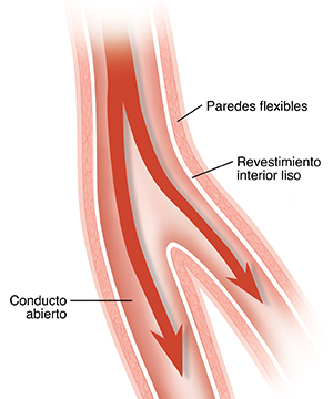 Corte transversal de una ramificación de una arteria saludable con flujo normal de sangre.