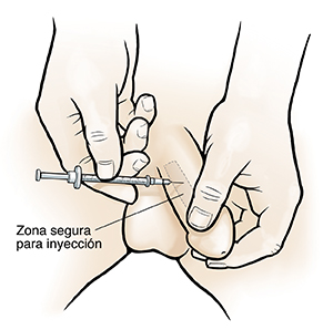 Primer plano de manos que inyectan medicamento en un lateral del pene.