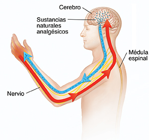 Contorno de una figura humana donde pueden verse el cerebro y la médula espinal. Las flechas indican señales de dolor que se transmiten hacia y desde el cerebro.