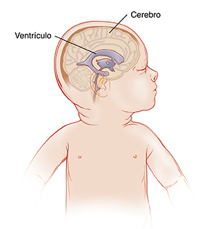 Vista lateral de la cabeza de un bebé donde se observan los ventrículos normales en el cerebro.
