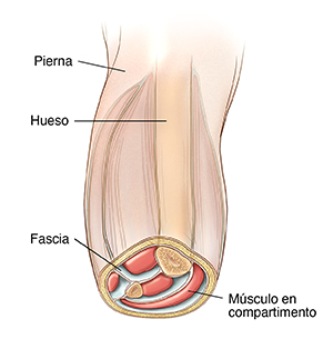 Vista frontal de una pierna con la parte inferior en corte transversal para observar los músculos en compartimentos.