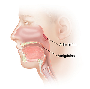 Vista lateral de la cabeza donde se observan las adenoides y las amígdalas.