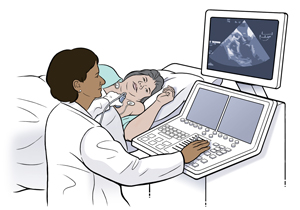 Mujer con una bata de hospital acostada de lado sobre la camilla de examen. Una proveedora de atención médica sostiene una sonda de ecocardiograma sobre el pecho de la mujer mientras observa el monitor.