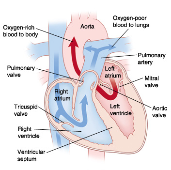 Front view cross section of heart showing normal aorta, pulmonary artery, mitral valve, aortic valve, left atrium, left ventricle, right atrium, right ventricle, tricuspid valve, pulmonary valve, superior vena cava, and inferior vena cava. Arrows on right side of heart show oxygen-poor blood pumping to lungs. Arrows on left side of heart show oxygen-rich blood pumped to body.